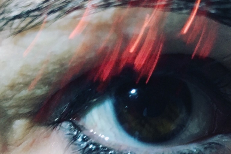 eye-with-red